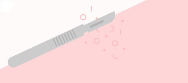 dermaplaning how it works example