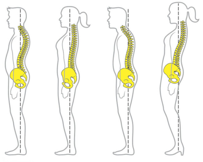 bad posture that causes problems